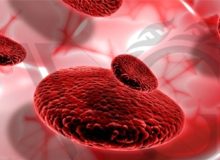 حقایقی که باید درباره بیماری تالاسمی بدانید